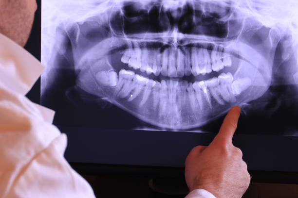 Best Emergency Dental Care for Abscessed Tooth in Sulphur Springs, TX